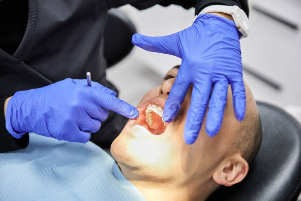 Best Mobile Emergency Dentist in Home Gardens, CA