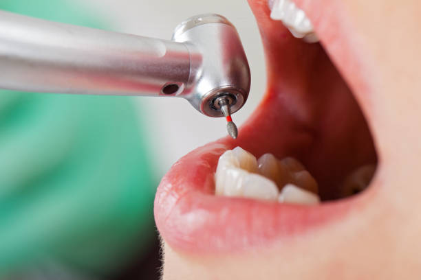 Best Urgent Dental Care for Toothache in Home Gardens, CA